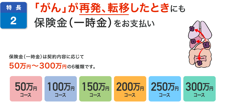 特長2 「がん」が再発、転移したときにも保険金(一時金)をお支払い